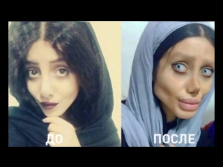 a girl from tehran had 50 operations to become like angelina jolie big tits big ass mature